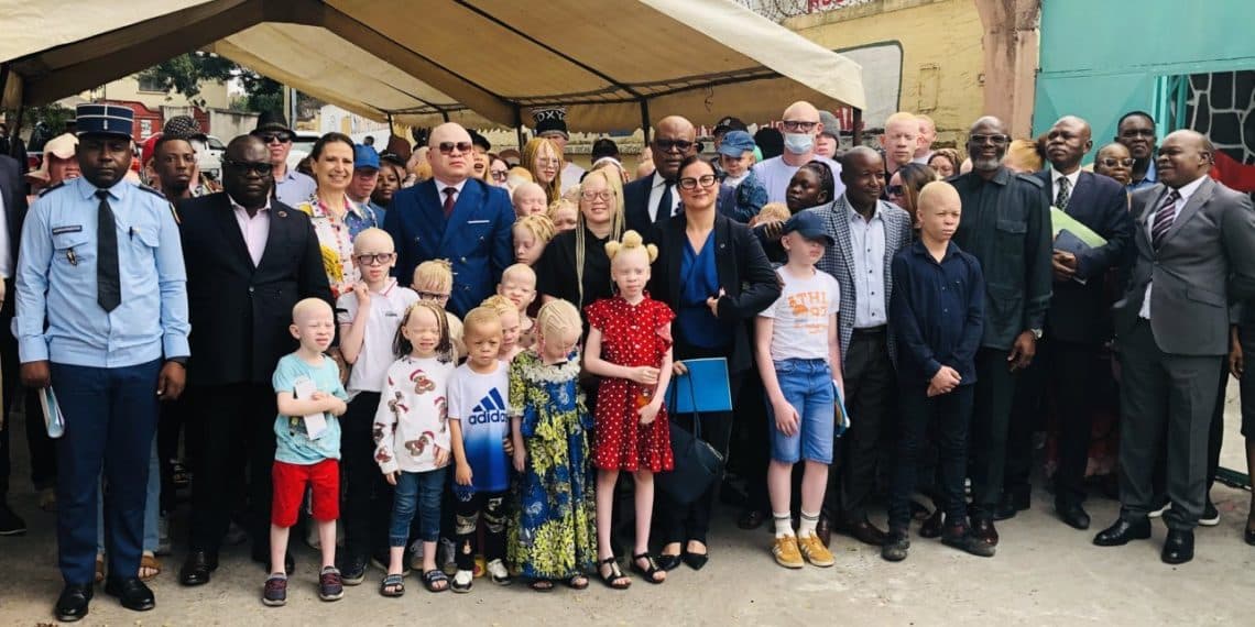 Droits de l'homme au Congo : Comment l'AJCA et une loi historique brisent l'enfer de la discrimination des albinos à Brazzaville