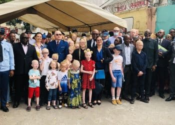 Droits de l'homme au Congo : Comment l'AJCA et une loi historique brisent l'enfer de la discrimination des albinos à Brazzaville